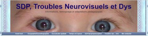 sdp troublesneurovisuels