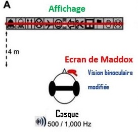Capture d’écran de la vidéo de Dove Medical Press, liée à l’article.