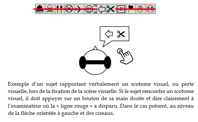 sujet rapportant scotome