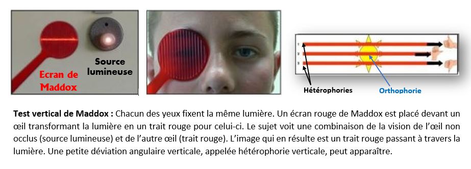 test vertical de Maddox